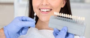 Sbiancamento dentale professionale dentista cinisello balsamo