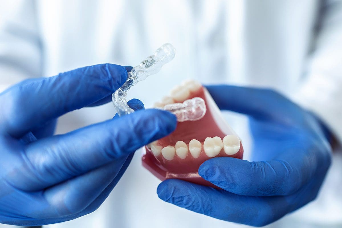 Affollamento Dentale - Dentista Cinisello Balsamo
