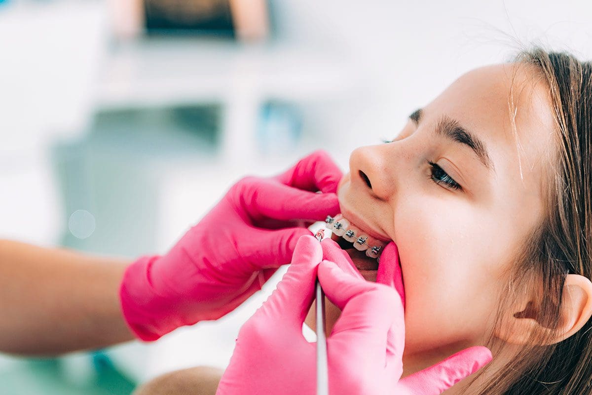 Affollamento Dentale - Dentista Cinisello Balsamo