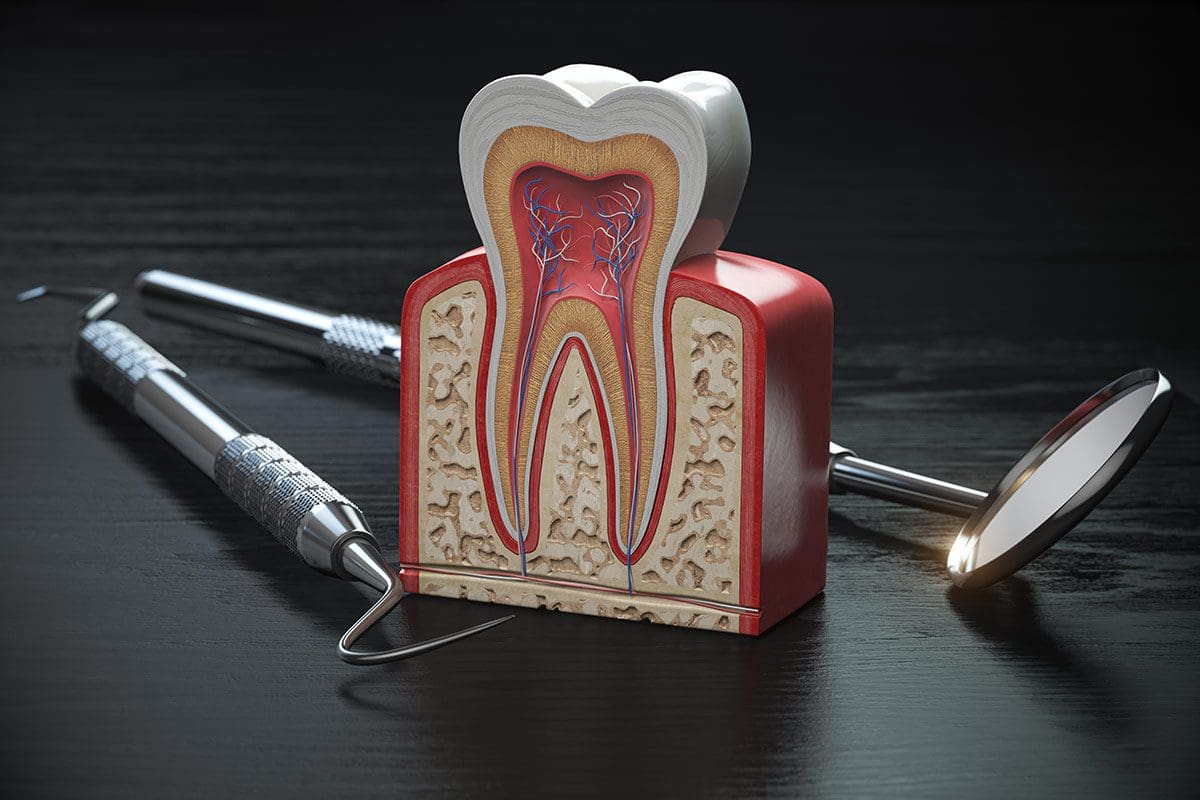 rigenerazione gengivale dental milano dentista cinisello balsamo