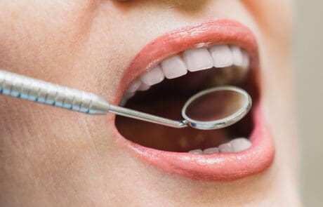 Denti fissi in giornata