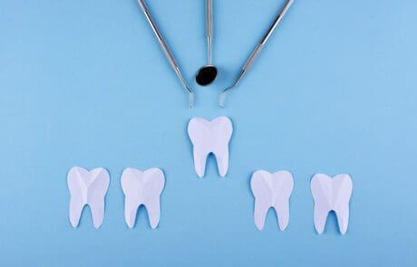 Ponte o impianto dentale