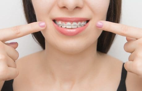 quanto costa un apparecchio per i denti