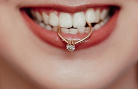 sbiancamento dentale matrimonio