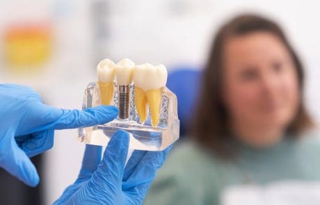 Impianti Dentali per pazienti speciali: Anziani, patologie sistemiche e osteoporosi