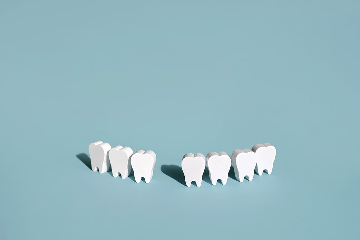 Denti mancanti, cosa accade se non li sostituisci