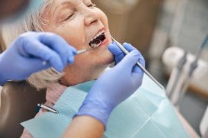 cura e manutenzione degli impianti dentali