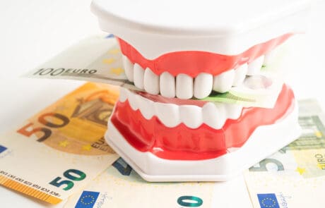 prezzi impianti dentali italia guida completa