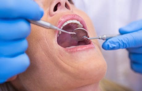granuloma dentale sintomi cause e cura definitiva
