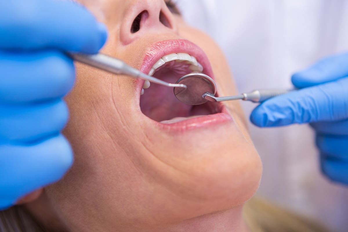 granuloma dentale sintomi cause e cura definitiva